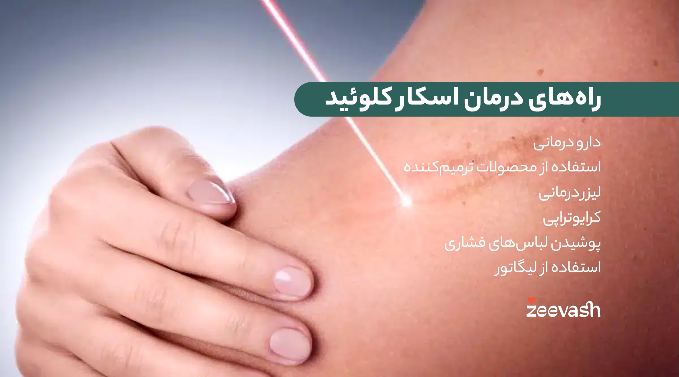 راه های درمان اسکار کلوئید